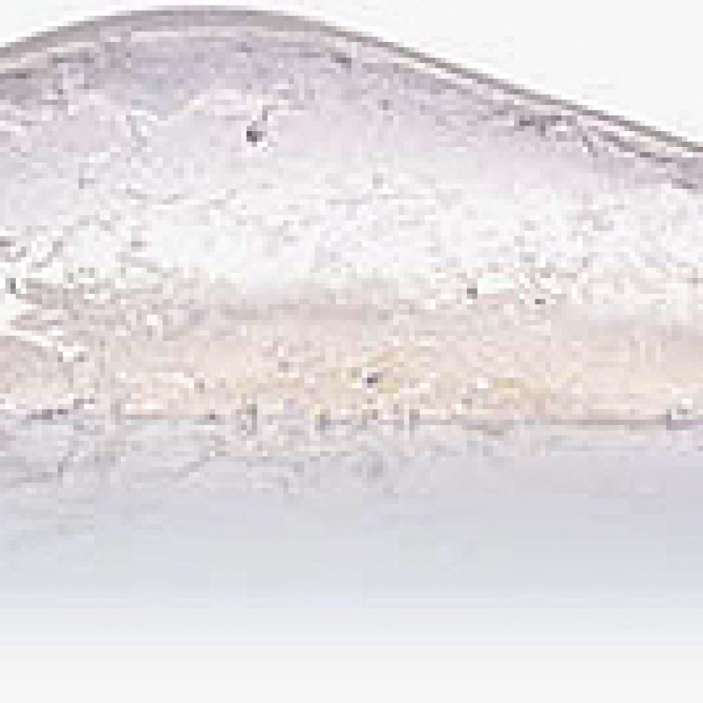 implante-de-gel-cohesivo-para-mamoplastia