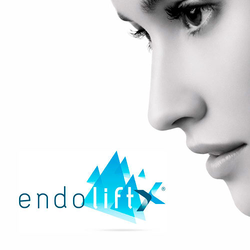 endoliftx-alicante